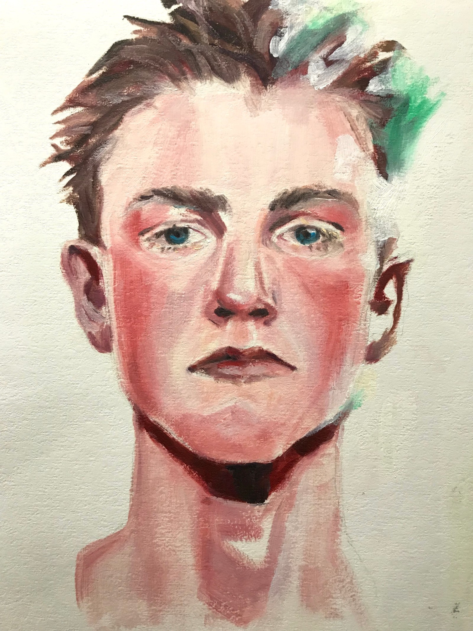 Boy with red cheeks